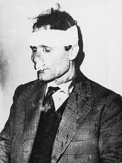 Ο Γ. Τσαρουχάς βαριά τραυματισμένος τη μέρα που δέχτηκε δολοφονική επίθεση ο Γρηγόρης Λαμπράκης (22/5/1963) 
