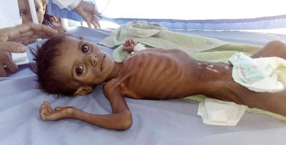 Yemen Pocket Of Famine