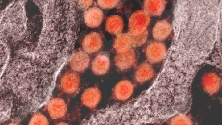 coronavirus farmaka
